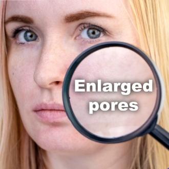 treatments enlarged-pores